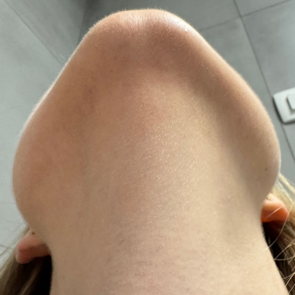 193
